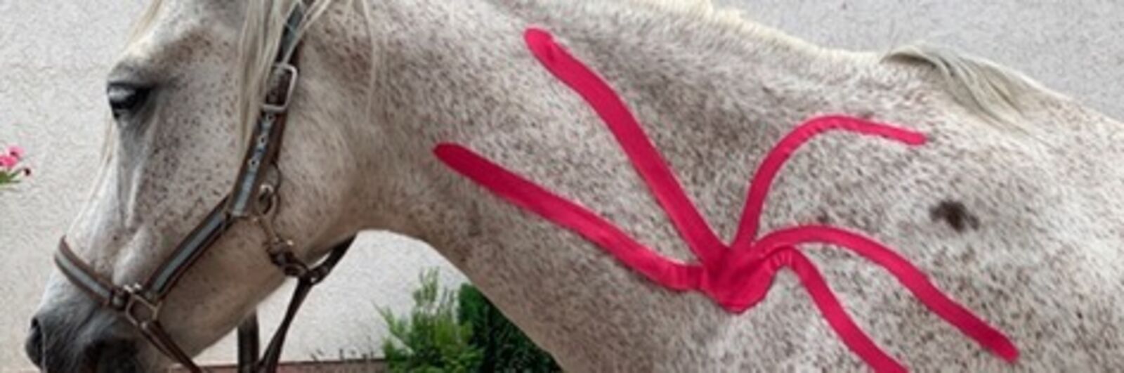 Kinesiotaping EWV News.jpg